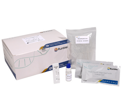 Dengue Virus NS1 Antígeno Rapid Test Kit (Golidal Gold)